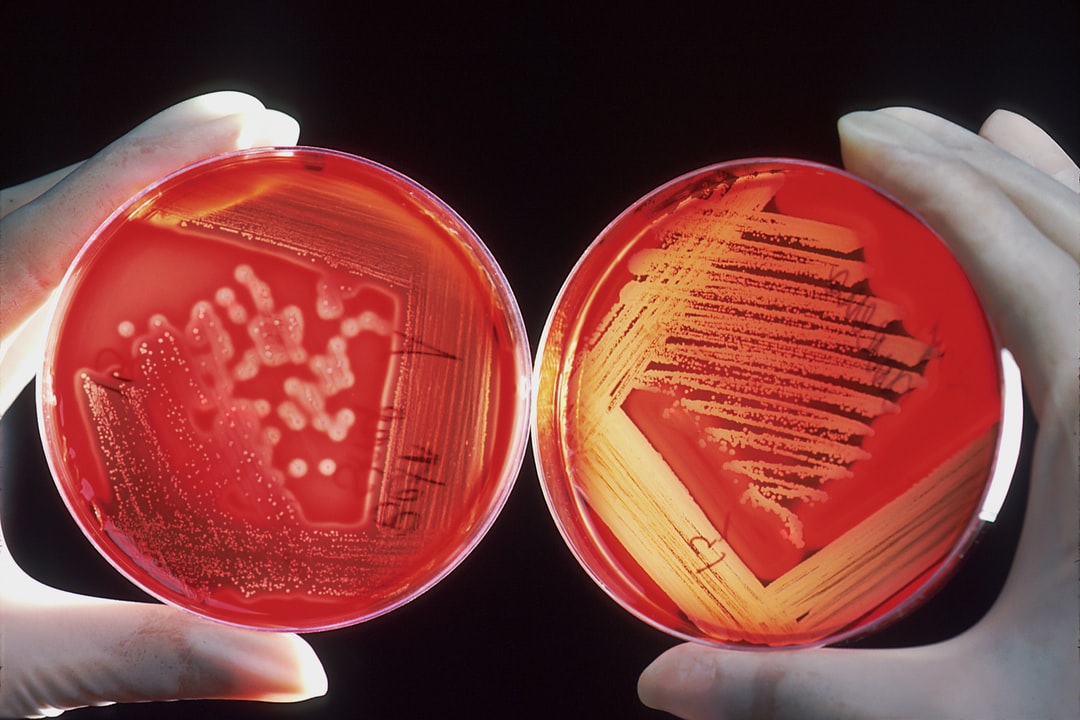 MZ o monitoringu sytuacji epidemicznej – Aktualności – COVID-19 – Medycyna Praktyczna