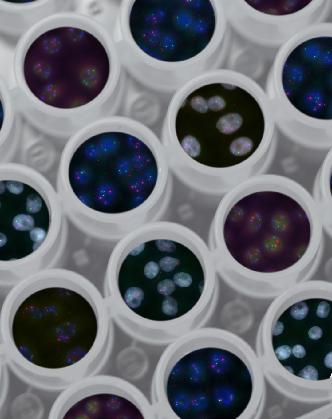 NIH Grant Funds Lupus Research in Children | Newsroom – Weill Cornell Medicine Newsroom
