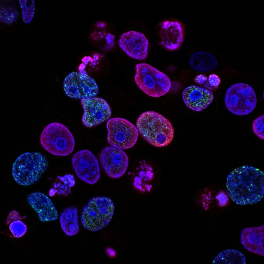 Bezpłatne szczepienia przeciw HPV dla dwóch roczników – Dentonet – największy portal stomatologiczny