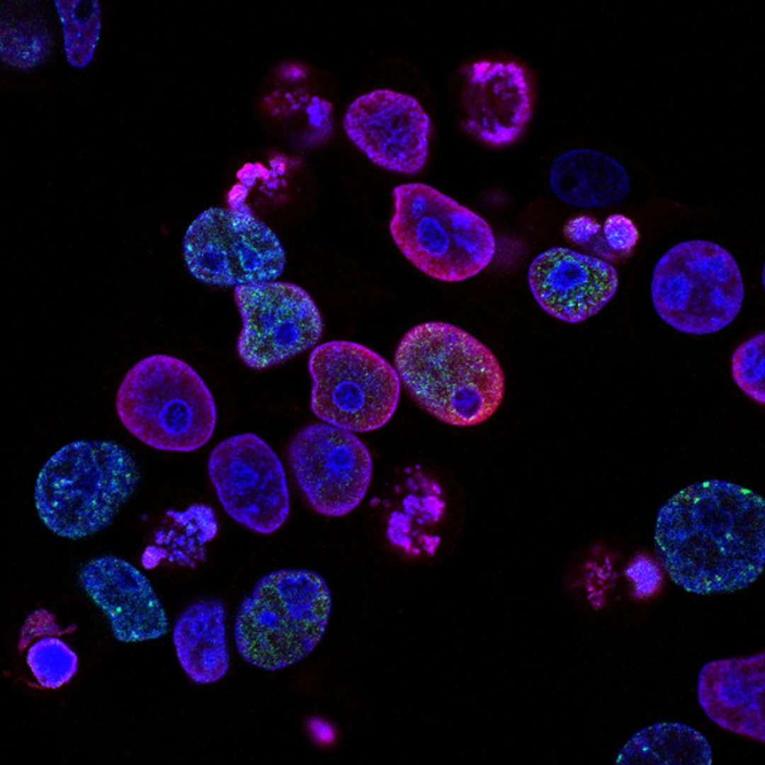 Pandemia COVID-19 nie została odwołana | Serwis Zdrowie – Serwis Zdrowie