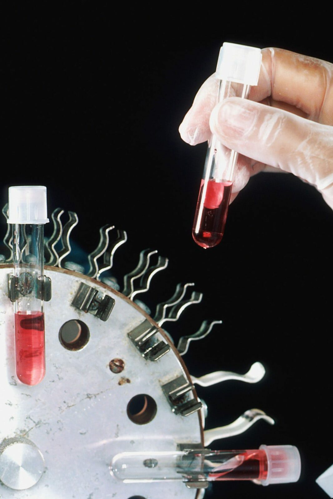 Is the Future of Medicine Hidden in Ancient DNA? – The New York Times