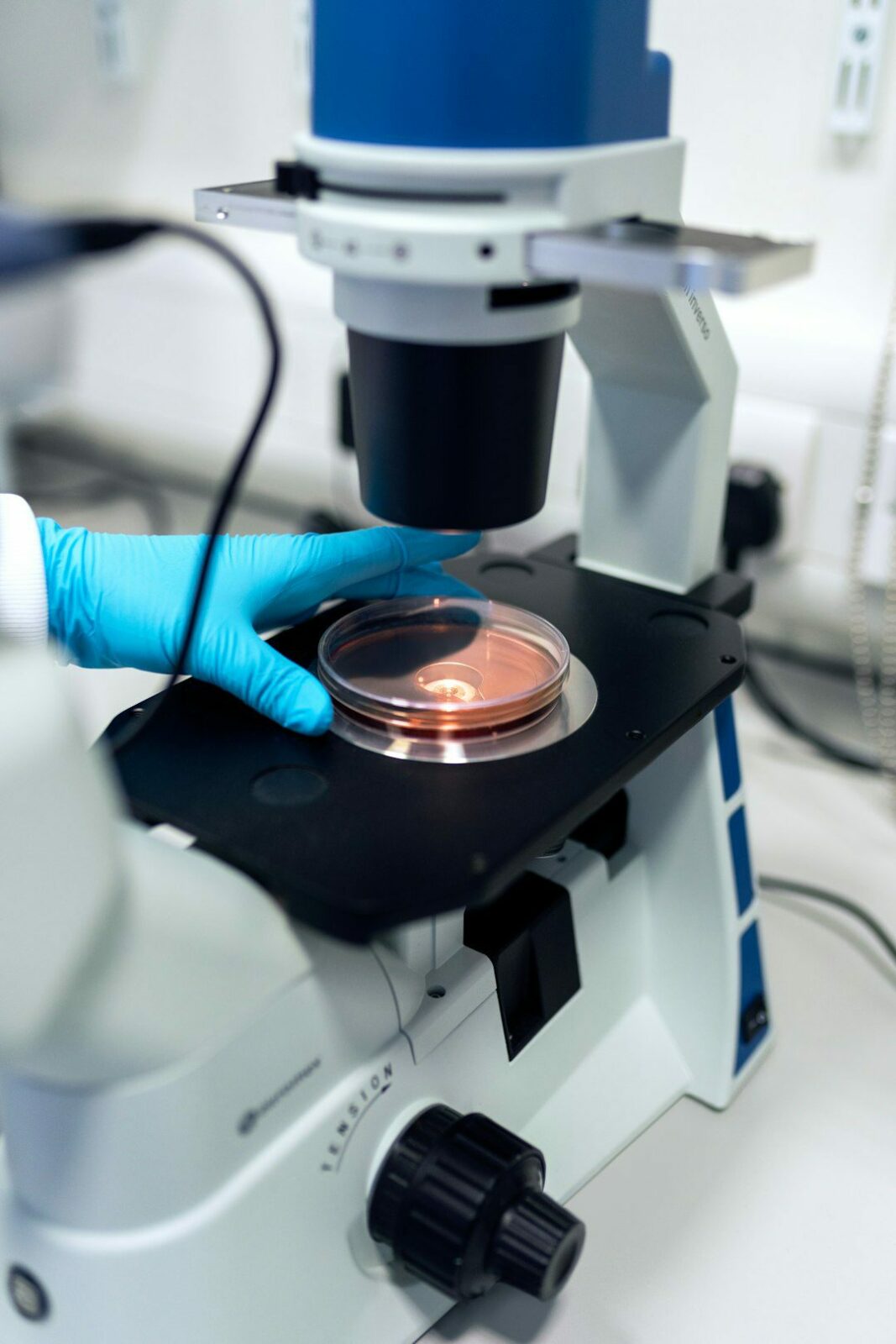 Our bacteria are more personal than we thought, Stanford Medicine-led study shows – Stanford Medical Center Report